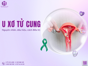 U xơ tử cung: Nguyên nhân, dấu hiệu, phương pháp chẩn đoán và cách điều trị