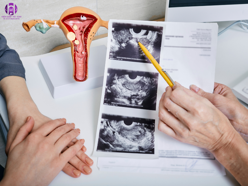 chẩn đoán lạc nội mạc tử cung bằng siêu âm
