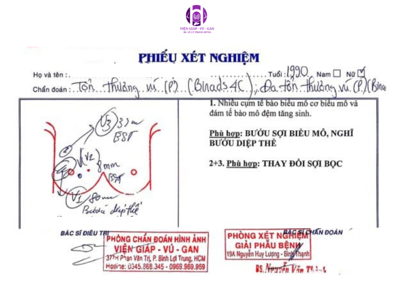 bướu diệp thể ác tính
