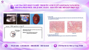 bướu lành tuyến giáp dạng nang